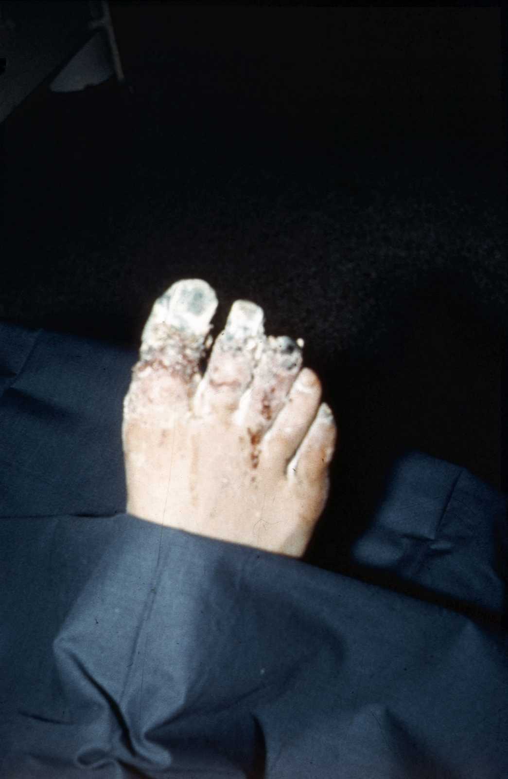 erciyasdagidezember65-slide10